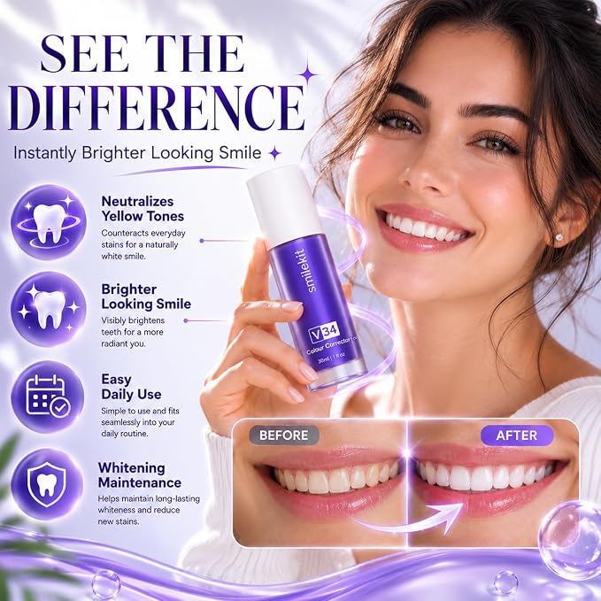 BLANQUEADOR DENTAL - SMILEKIT - V34 - 30 ML - Imagen 2